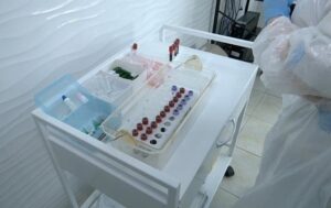 Новини України - У Києві зафіксовано 83 випадки захворювання на гепатит А